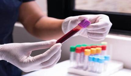 Homem é condenado a indenizar ex-companheira após transmissão do vírus HIV em SC