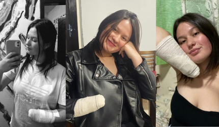 "O que aconteceu comigo, eu não desejo nem a ele", desabafa jovem que perdeu mão após ataque do ex