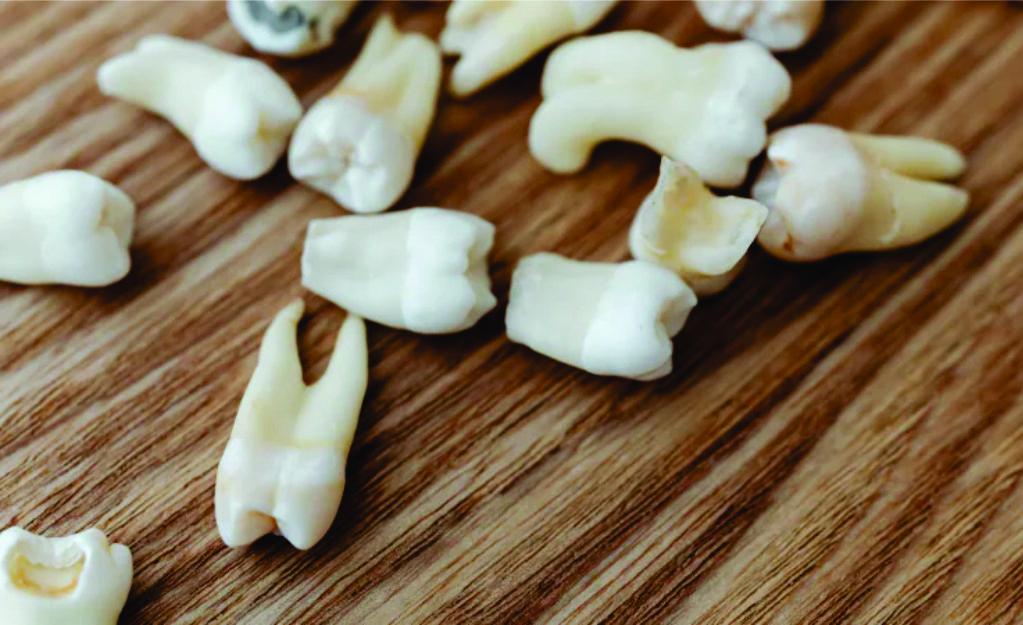 Adeus, dentaduras?  Cientistas cultivam dentes em laboratório e testam droga para